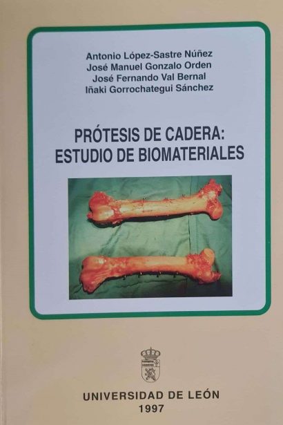 Prótesis de cadera: estudio de biomateriales.